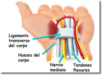 TUNEL CARPIANO